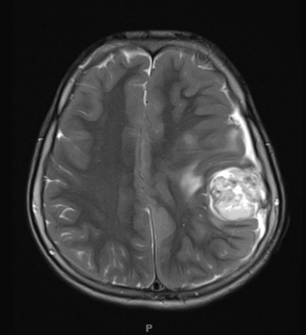 5A2 ETANTR (Case 5) T2 1 - Copy