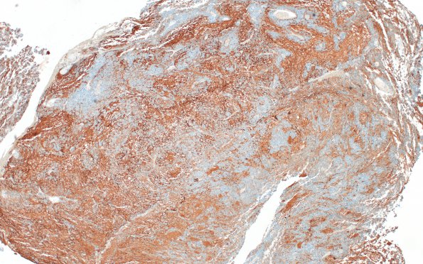 7C1 ETMR (Case 7) SYN 1