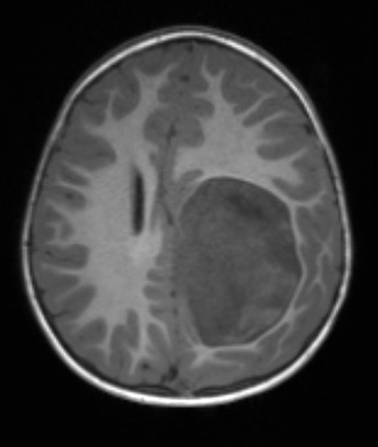 8A1 ETMR (Case 8) T1 noC - Copy