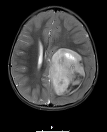 8A3 ETMR (Case 8) T2W 1 - Copy