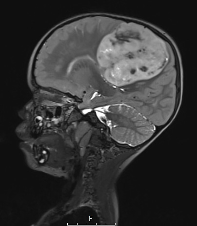 8A4 ETMR (Case 8) T2W - Copy