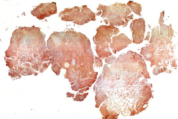 8C1 ETMR (Case 8) SYN B1 WM