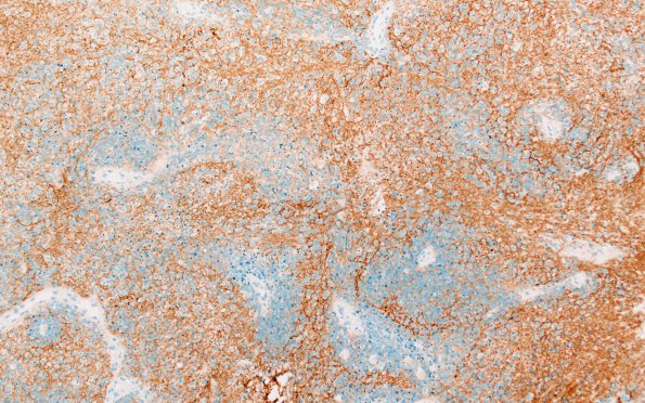 8C3 ETMR (Case 8) B1 SYN 10X 2