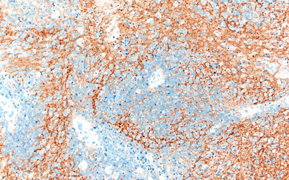 8C4 ETMR (Case 8) B1 SYN 20X 1