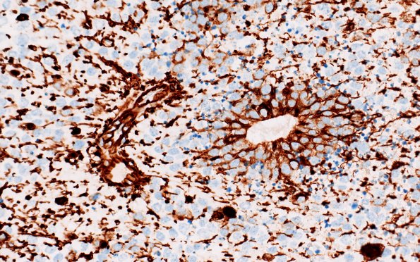 8H2 ETMR (Case 8) B1 VIM 40X