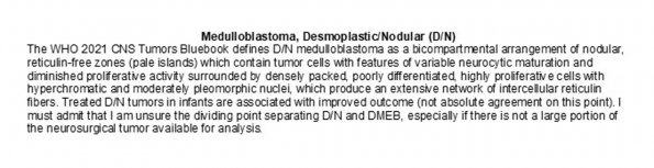 0A Desmoplastic Medulloblastoma (DN)