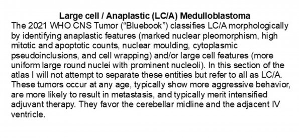 0A Medulloblastoma, LCA - Text