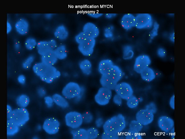 2F1 MB LCA (Case 2)  2 - Copy