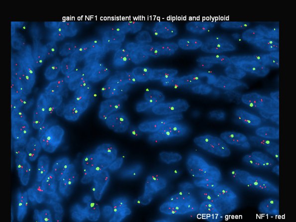 2F3 MB LCA (Case 2) 17 - Copy