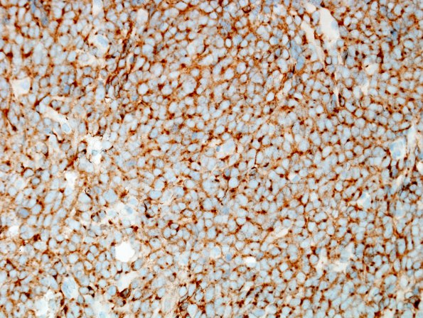 1B1 MedMyoB Glial (Case 1) Area 3 SYN.jpg