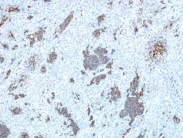 2C2 MedMyoBl LC-A (Case 2) SYN 9