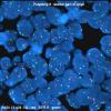 2F2 MedMyoBl LC-A (Case 2) c8-cmyc dense