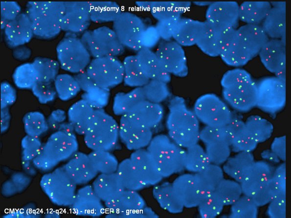 2F2 MedMyoBl LC-A (Case 2) c8-cmyc dense