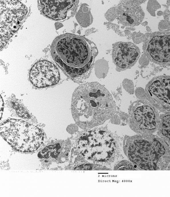 2H4 MedMyoBl LC-A (Case 2) EM 015 - Copy