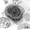 2H5 MedMyoBl LC-A (Case 2) EM 016 - Copy