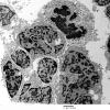 2H9 MedMyoBl LC-A (Case 2) 018 - Copy