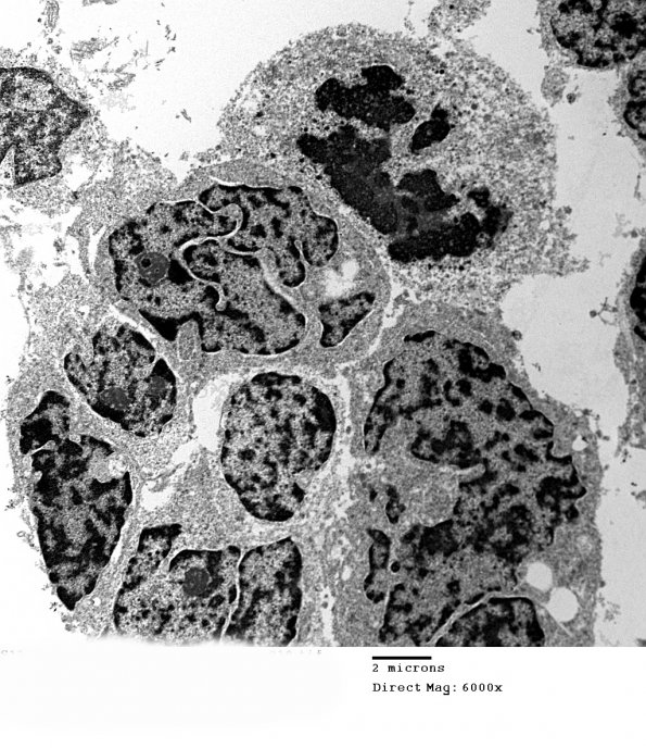 2H9 MedMyoBl LC-A (Case 2) 018 - Copy