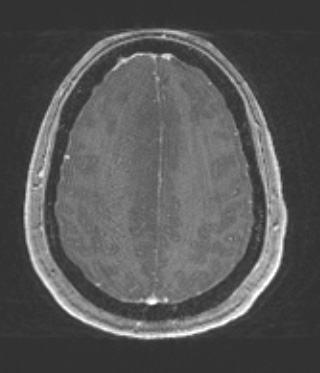 8A2 (Case 8) T1W - Copy