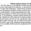 0A Diffuse Midline Glioma, H3 K27 Altered - Text