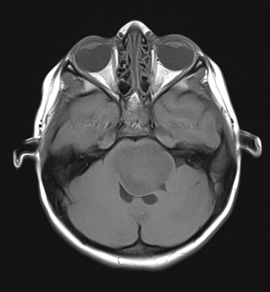 16A2 DMG (Case 16) T1NoC AX - Copy