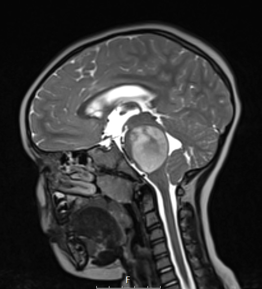 16A3 DMG (Case 16) T2 w - Copy