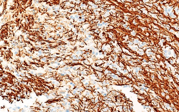 16C DMG (Case 16) NF 20X