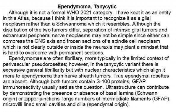 0A Ependymoma, tanycytic - Text