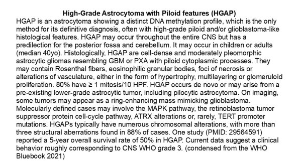 0A High Grade Astrocytoma with Piloid Features - HGAP