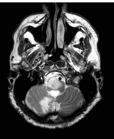 3A2 HGAP (Case 3) T2noC - Copy