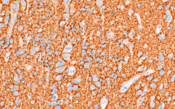 1D2 PLNTY (Case 1) A2 SYN 40X 1