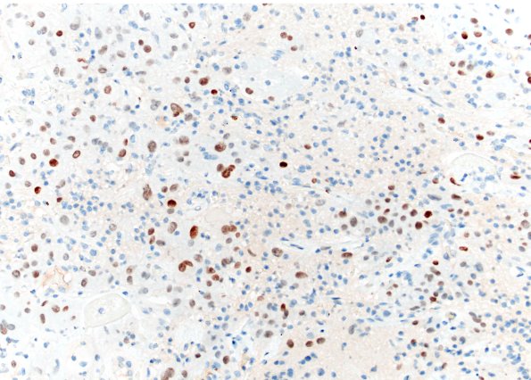 20M SEGA (Case 20) TTF 20X 2