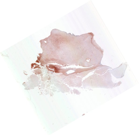 21D1 SEGA (Case 21) S100 WM