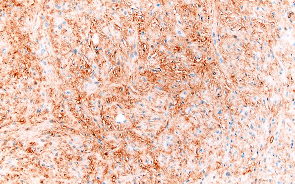 21D2 SEGA (Case 21) S100 20X1