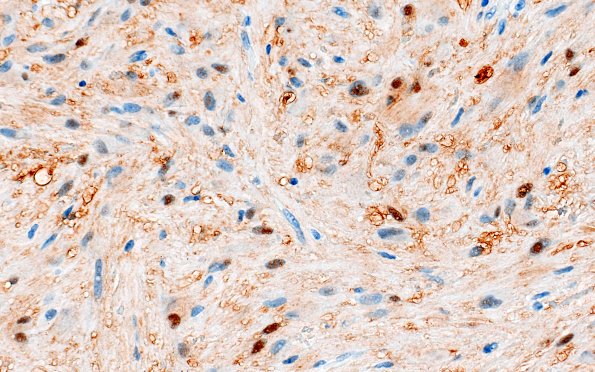 21D3 SEGA (Case 21) S100 40X 1