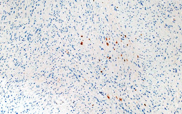 21E1 SEGA (Case 21) NeuN 10X