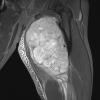 23A2 (Case 23) STIR DRB NoC - Copy