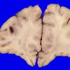 23C1 (Case 23) 006