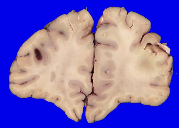 23C1 (Case 23) 006