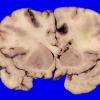 23C2A (Case 23) 010
