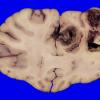 23C3A Case 23.A.022