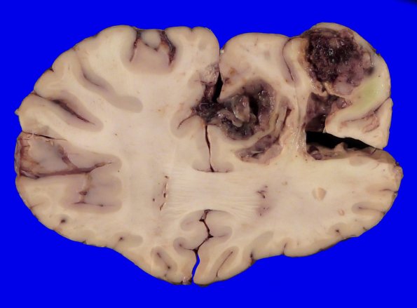 23C3A Case 23.A.022