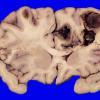 23C4A (Case 23) 026