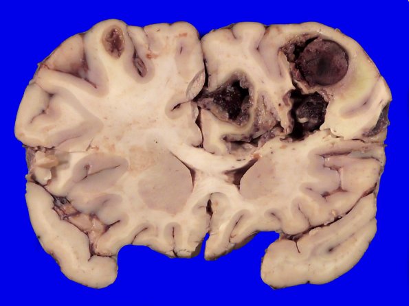 23C4A (Case 23) 026
