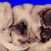 23C4B (Case 23) 027