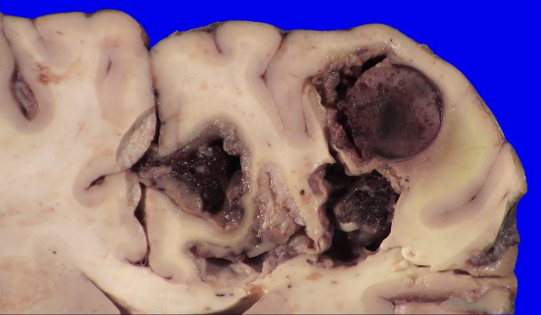 23C4B (Case 23) 027