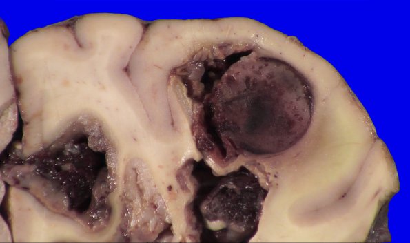 23C4C (Case 23) 028