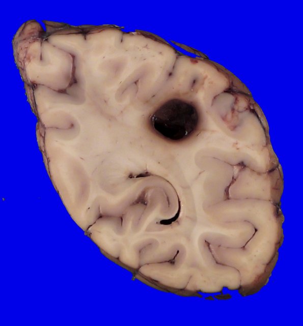 23C5 (Case 23) 029