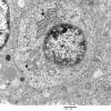 3H4 Neurocytoma, central (Case 3) EM 27 - Copy