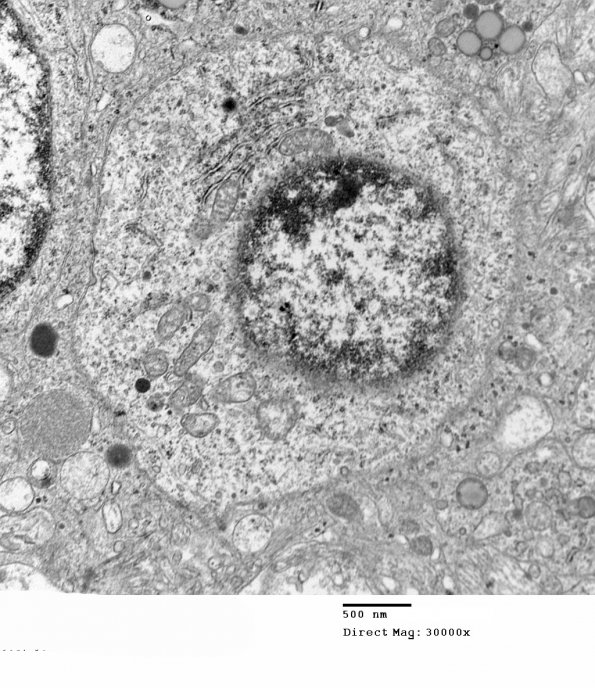 3H4 Neurocytoma, central (Case 3) EM 27 - Copy