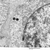 3H6 Neurocytoma, central (Case 3) EM 40 - Copy